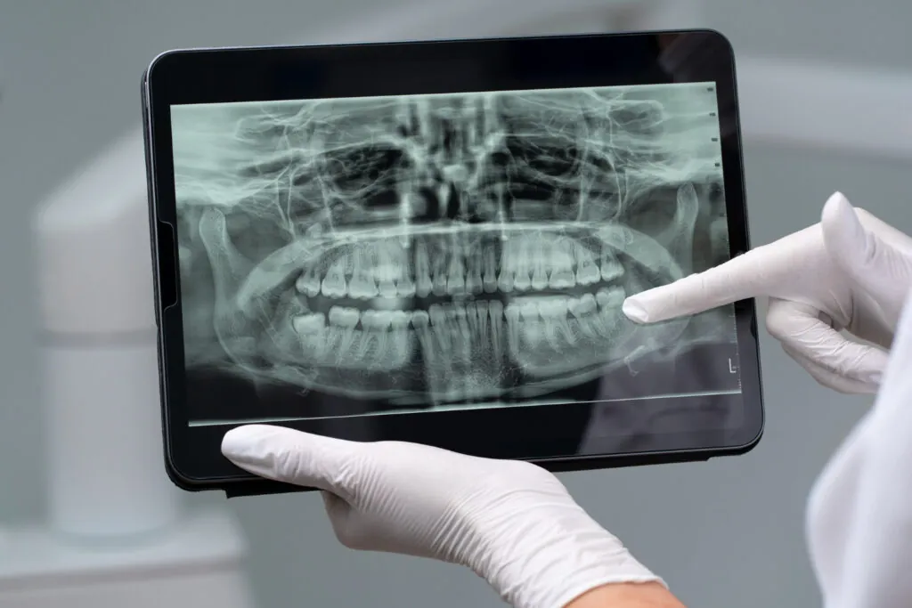 Dental X-ray on a tablet