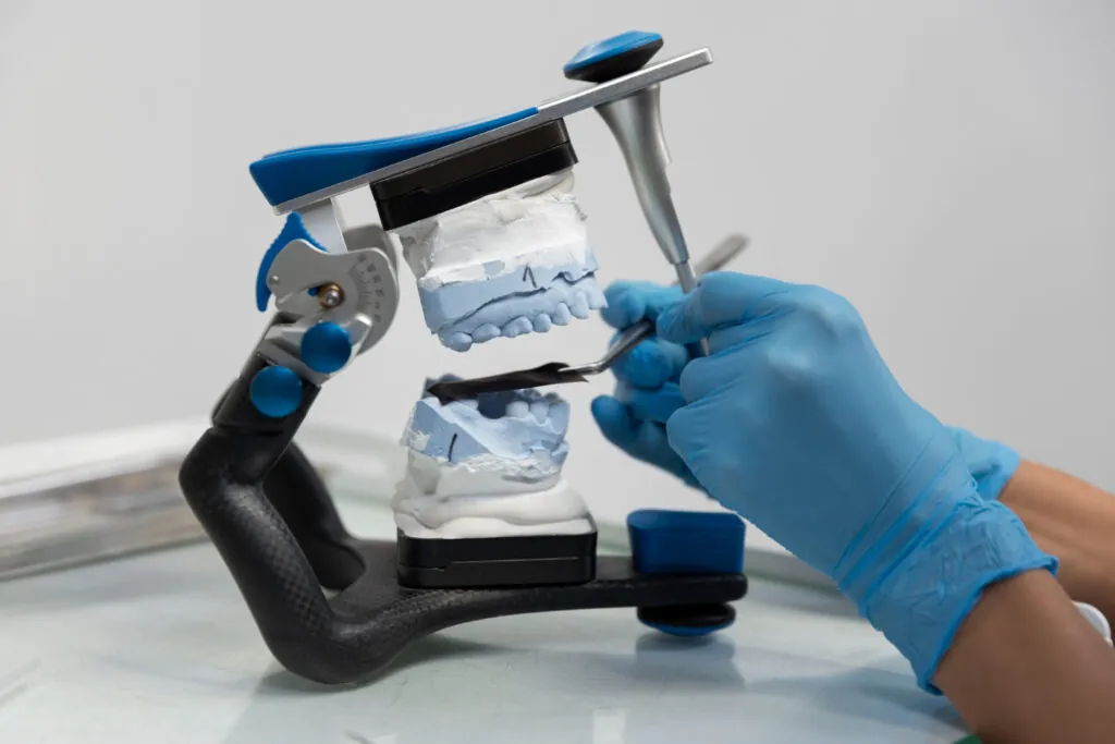 Dental models mounted on an articulator