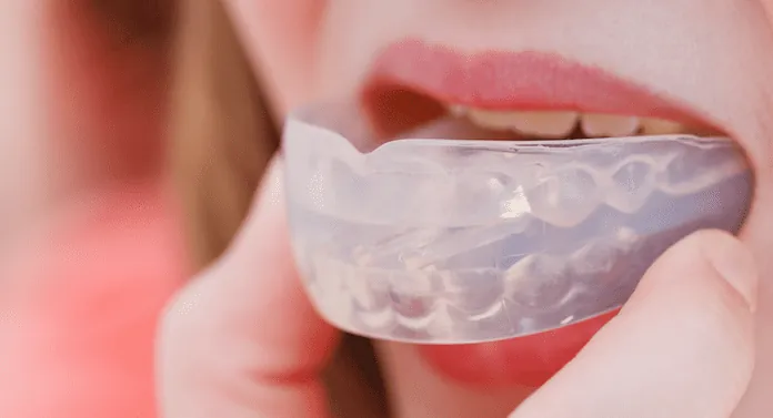 Clear custom mouth guard on upper teeth