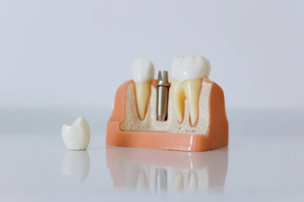 Dental implant model next to a crown